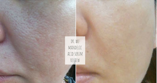 Dr. Wu Intensive Renewal Serum With Mandelic Acid 18 before and after