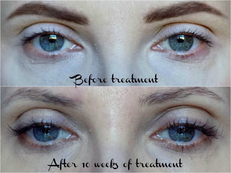 NYK1 Lash Force Eyelash Growth Serum - Before and After pictures - thin coat