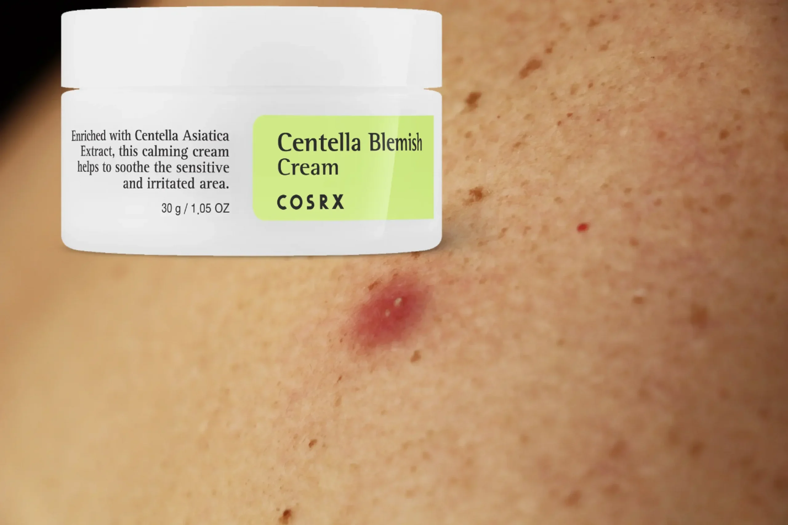 Cosrx Centella Blemish Cream Review