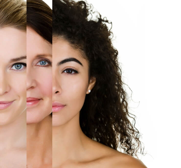 different skin types