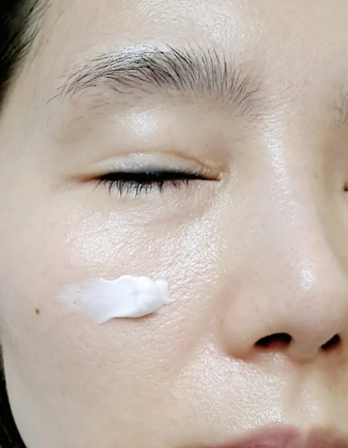 Moisturizing is important when Tretinoin Peeling 