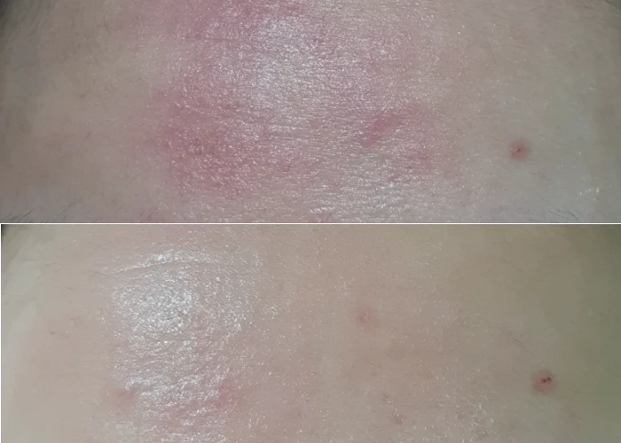 Real Barrier Extreme Cream Before & After